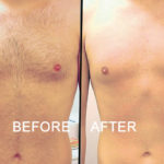 Theresa’s Face and Body offers personalized electrolysis treatments Men's Electrolysis